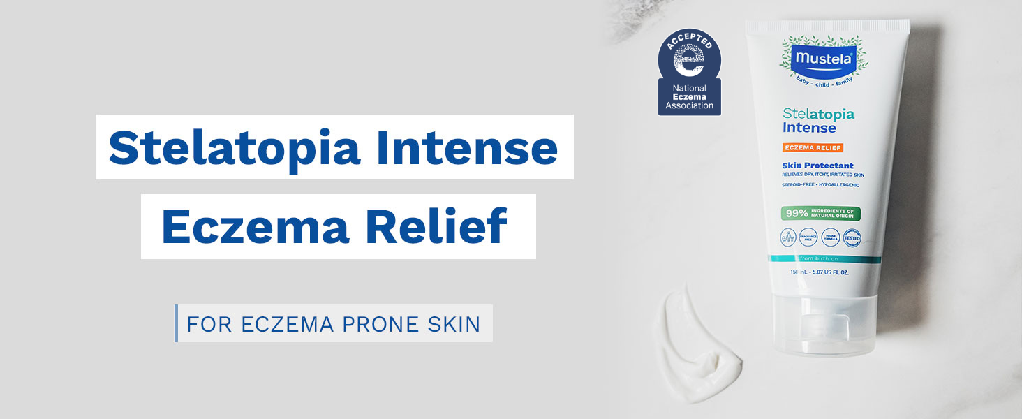 Mustela Eczema Relief Cream Stelatopia Intense Eczema Relief Mustela Eczema Relief Cream Stelatopia Intense Eczema Relief